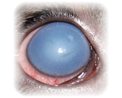 Глаукома: причины, симптомы, диагностика, операция и осложнения